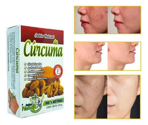 (Pack 2 Und) Jabón Viral de Cúrcuma 100% Natural