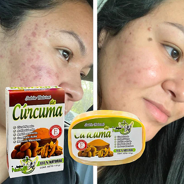 (Pack 2 Und) Jabón Viral de Cúrcuma 100% Natural