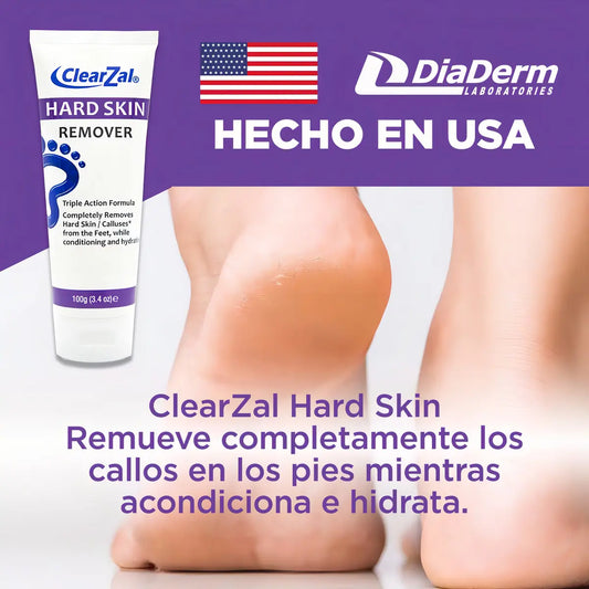 Crema Removedora de Callos ClearZal